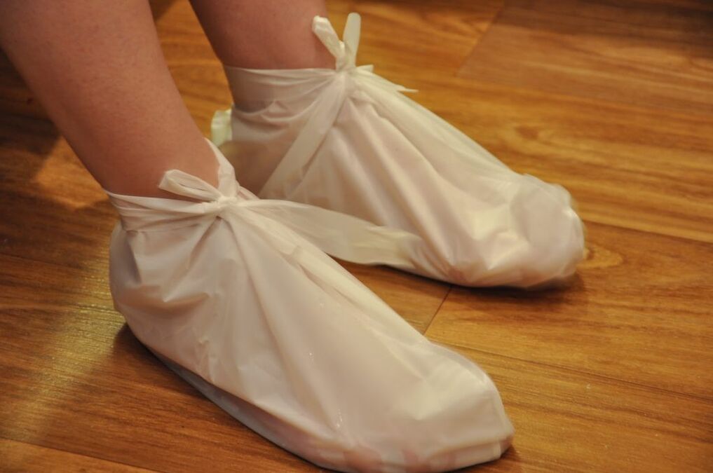 Compresses pour l'arthrose de la cheville