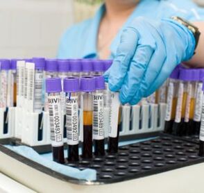 Prise de sang pour diagnostiquer les douleurs articulaires