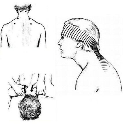 Douleurs musculaires au cou et massage analgésique